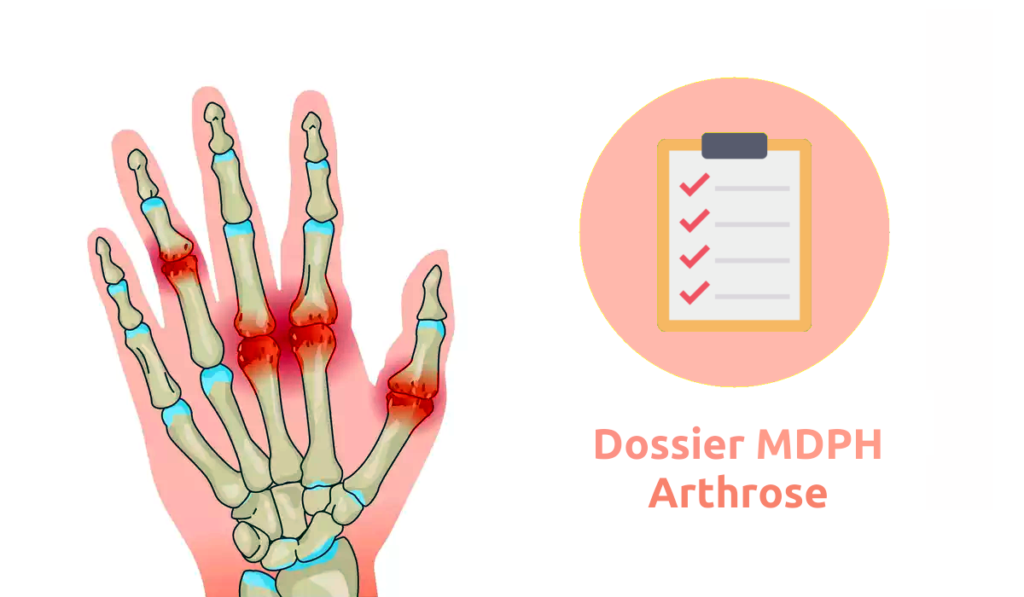 Dossier MDPH arthrose suite pour la reconnaissance RQTH