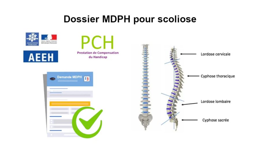 dossier mdph scoliose grave